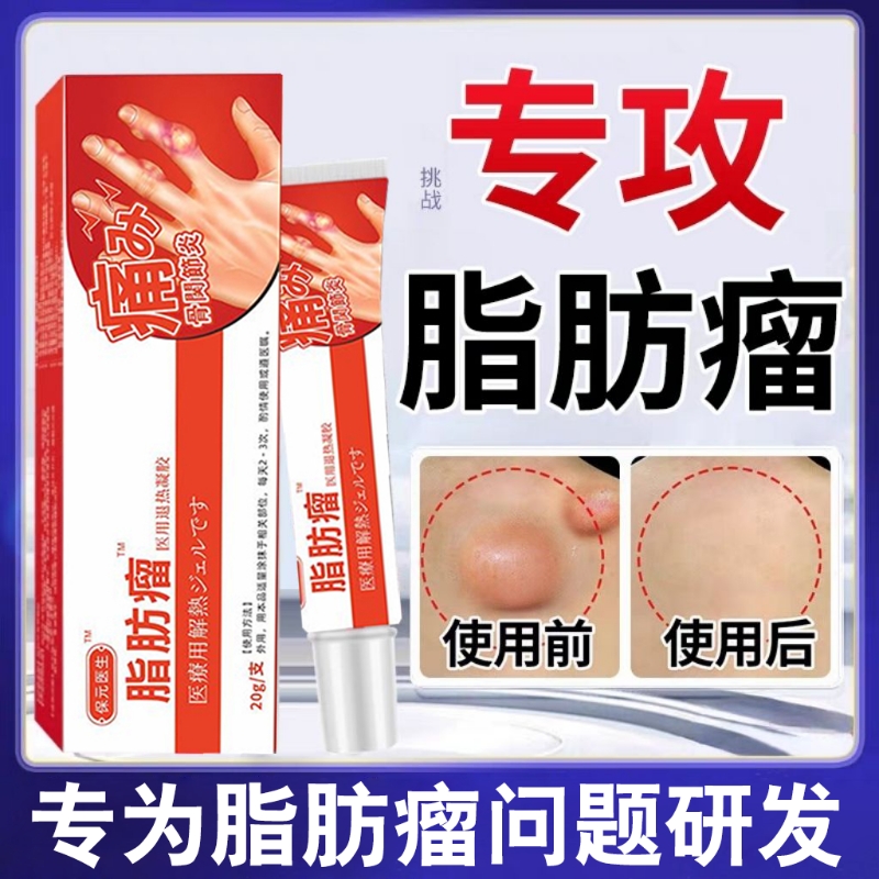 保元制药消瘤药膏皮肤纤维瘤手指肿胀变形凝胶特肿硬块脂肪瘤去除