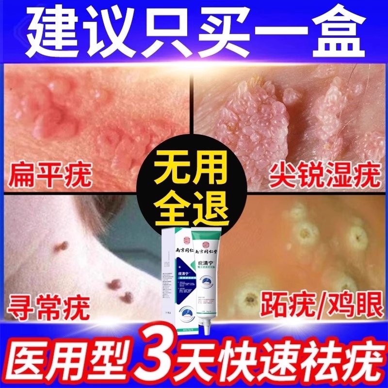 胖東来严选】同仁堂祛疣销量NO.I