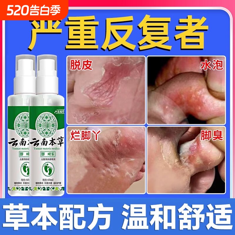 云南本草脚気喷雾止痒脱皮杀菌脚臭膏真菌感染专用喷剂健康抑菌