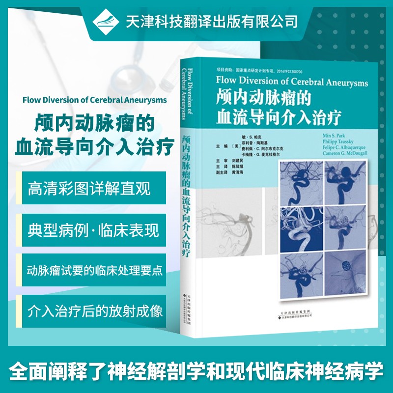 颅内动脉瘤的血流导向介入治疗