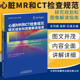 药物负荷下 CMR研究 9787543339408天津科技翻译出版 心脏MR和CT检查规范 公司 拉道主编 研究规划和图像解读指南 庞斯 正版 吉列姆