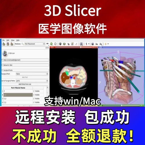 3D Slicer 3Dslicer医学图像三维可视化软件赠全套使用教程win/Ma