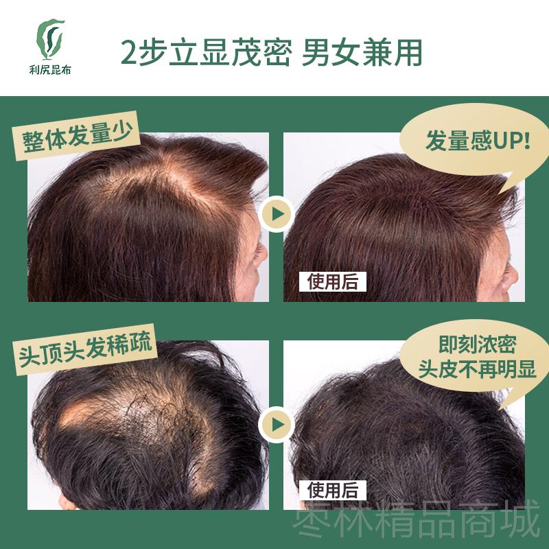 正品日本利尻昆布增发纤维密发粉+定型喷雾际线假补发发增发发神