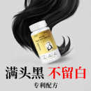 维生素h黑发片b6b7生物素防脱发白发转黑颗粒官方旗舰店正品