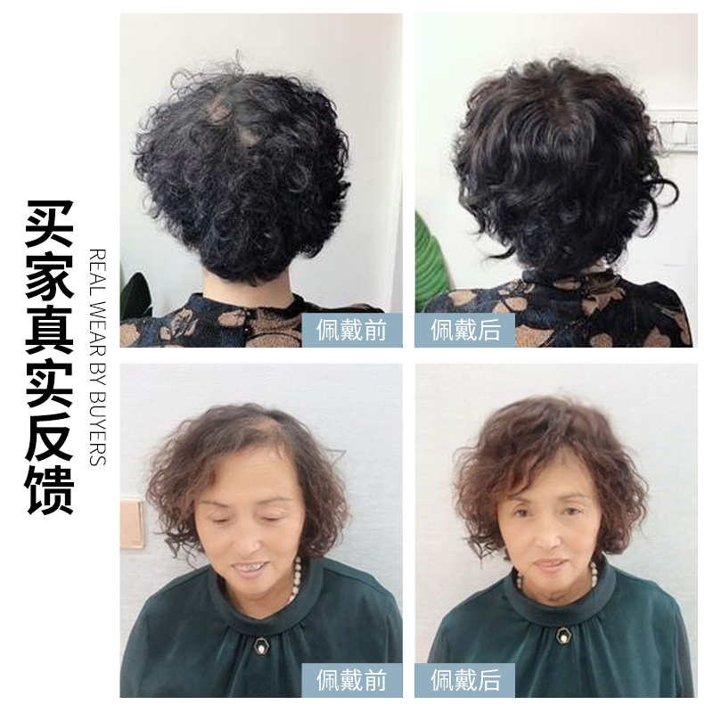 假发女片头顶轻薄卷发蓬松增发量遮白发补头顶小卷发刘海真发发块