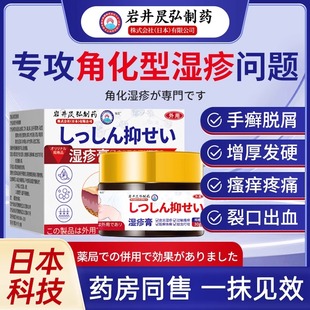 角化型湿疹手癣膏脱皮干裂真菌感染慢性角质化皲裂性手部湿疹脚部