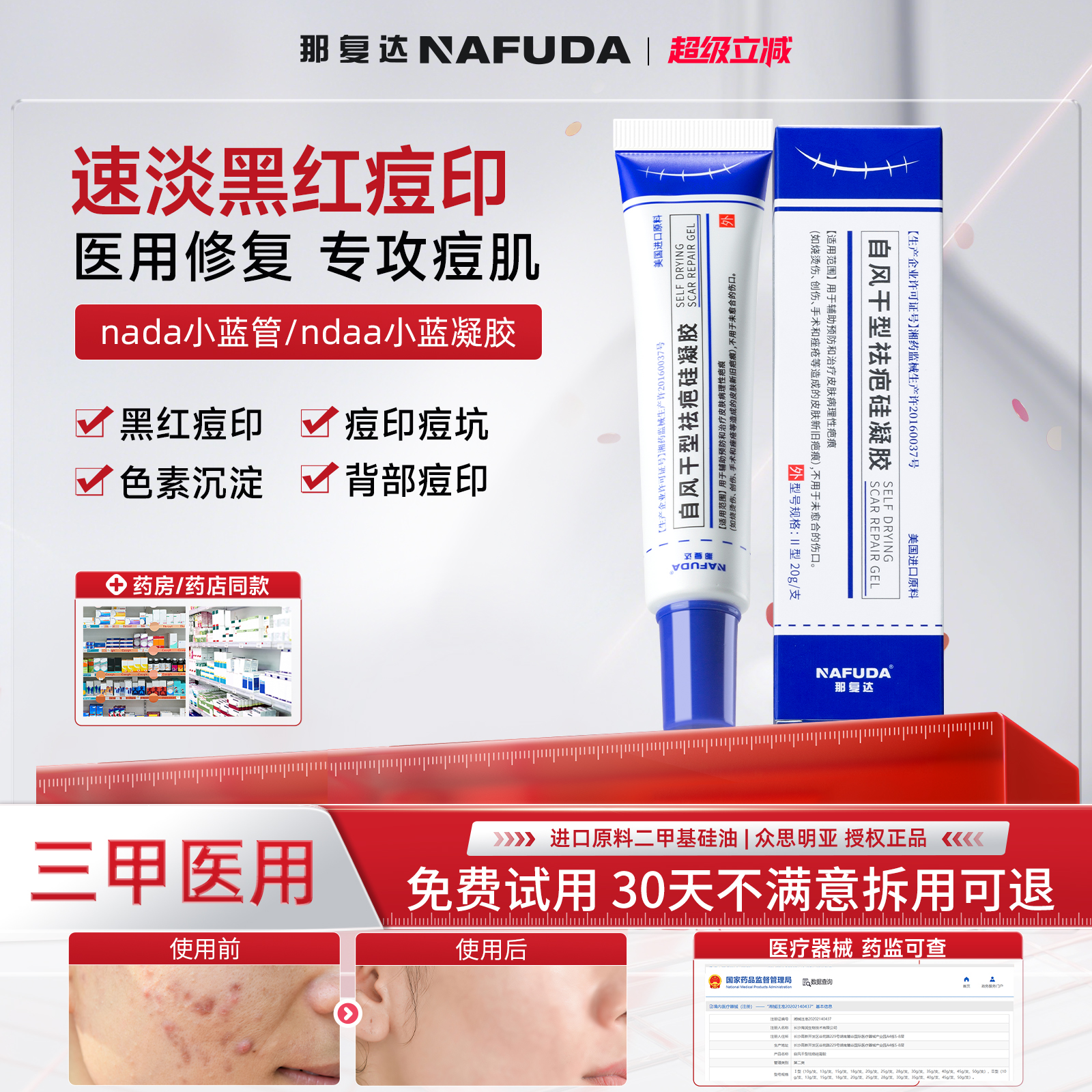 （官方正品）nada小蓝管ndaa小蓝凝胶uda淡化脸部痘印痘痘硅凝胶