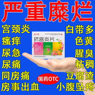 治疗宫颈炎的药宫颈糜烂妇科炎症重度专用中药宫颈炎症抗宫炎片ZM