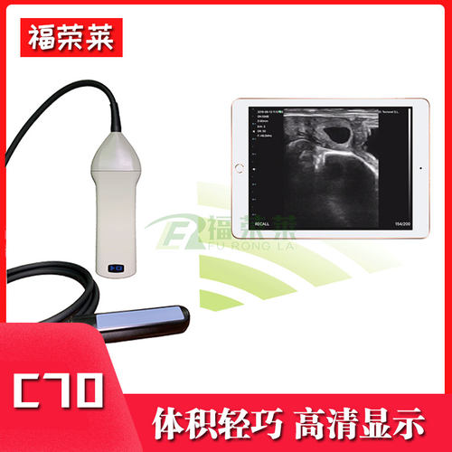 无线牛用B超机C70 彩色母牛用B超测孕仪 牛马驴用B超兽用