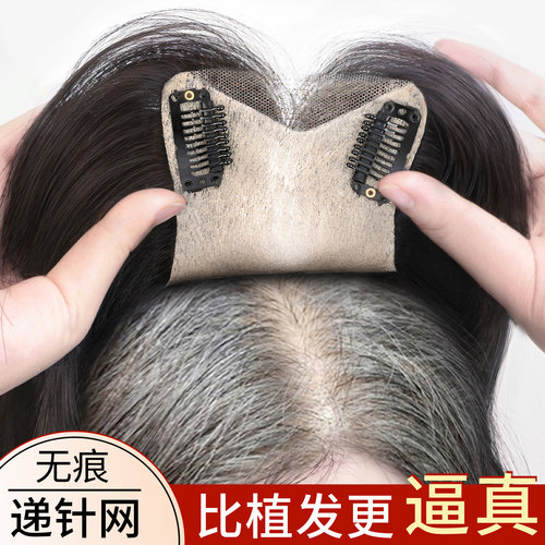 天空树【十月新品】递针无痕补发