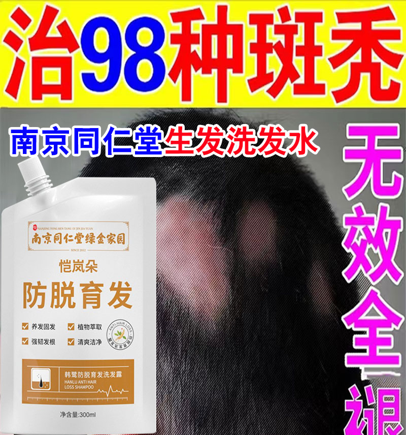 治疗斑秃特效鬼剃头药斑脱生发液防脱发生发剂男士专用剂洗发水膏