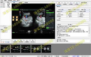 超声软件高清版胃肠镜宫腹腔镜耳鼻喉镜支气管镜膀胱镜软件高清版