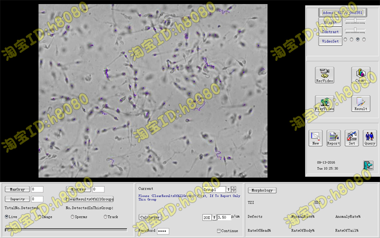 英文版精子分析软件质量