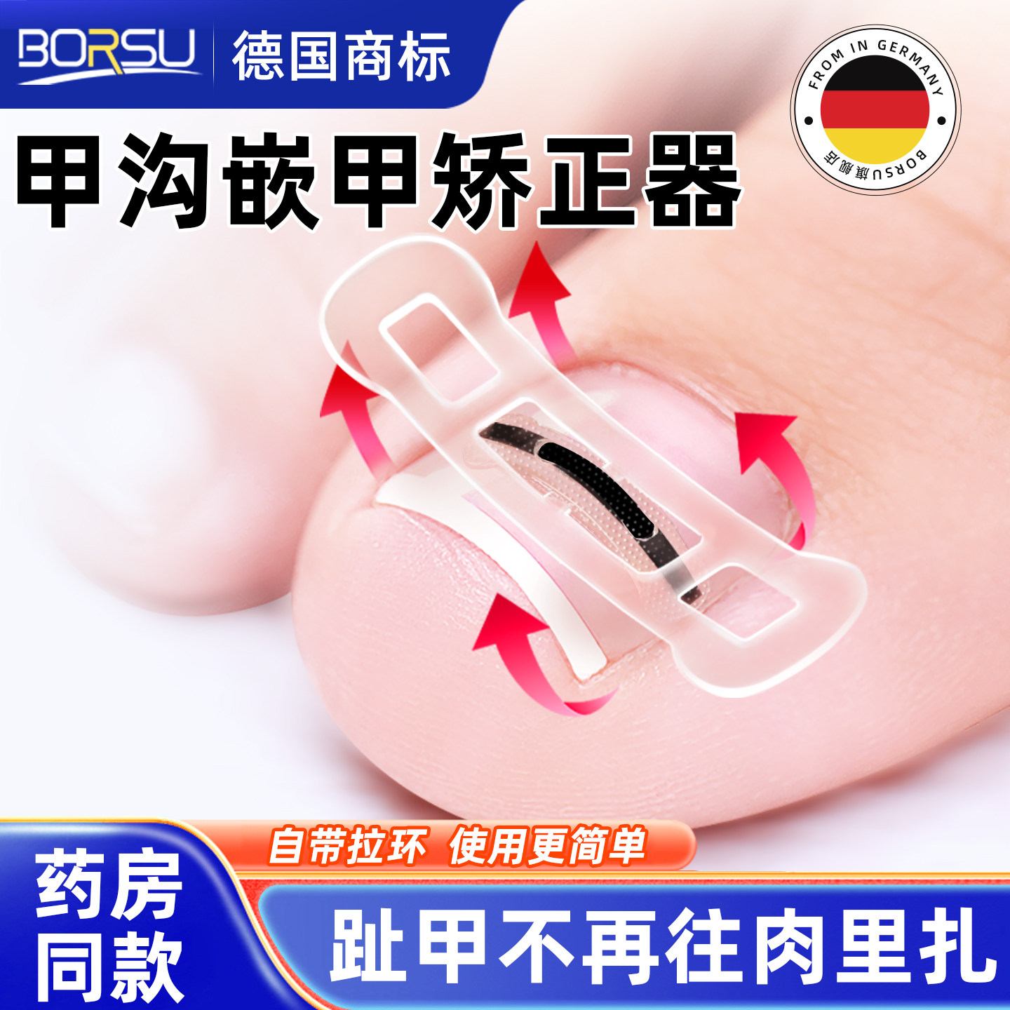 【易拉环专利】使用便捷科学矫正
