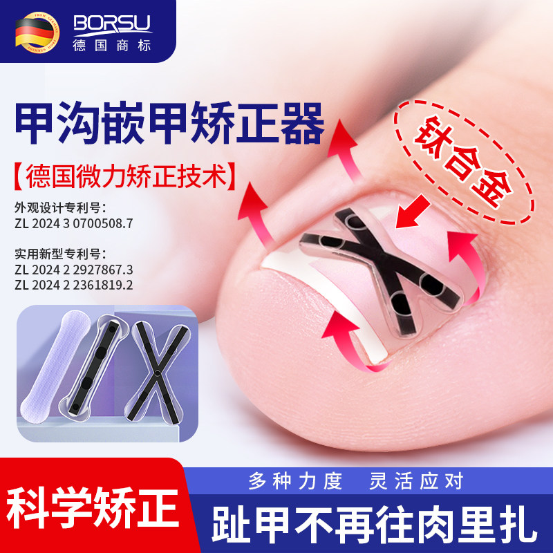 德国BORSU甲沟嵌甲矫正器炎正甲贴片脚趾指甲刀剪往肉里长专用贴
