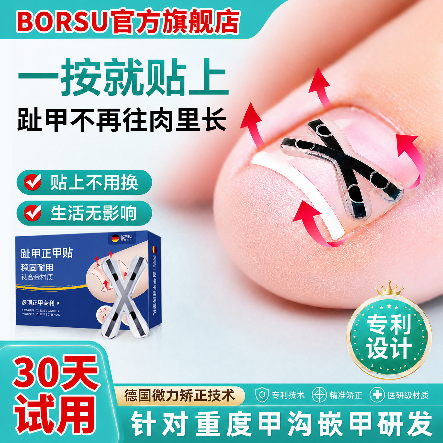 BORSU德国重度甲沟嵌甲炎专用矫正器正甲贴片脚趾指甲肉里长刀剪