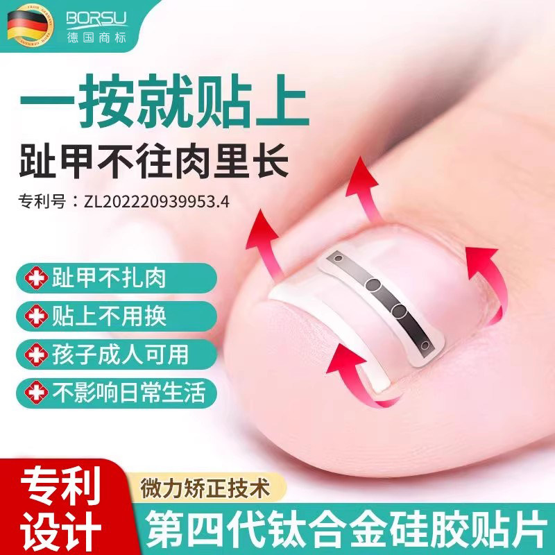 德国BORSU甲沟嵌甲矫正器炎正甲贴贴片脚趾指甲扎肉专用纠正神器,家庭/个人清洁工具,指甲钳,淘宝优惠券,粉丝福利购,淘宝优惠卷