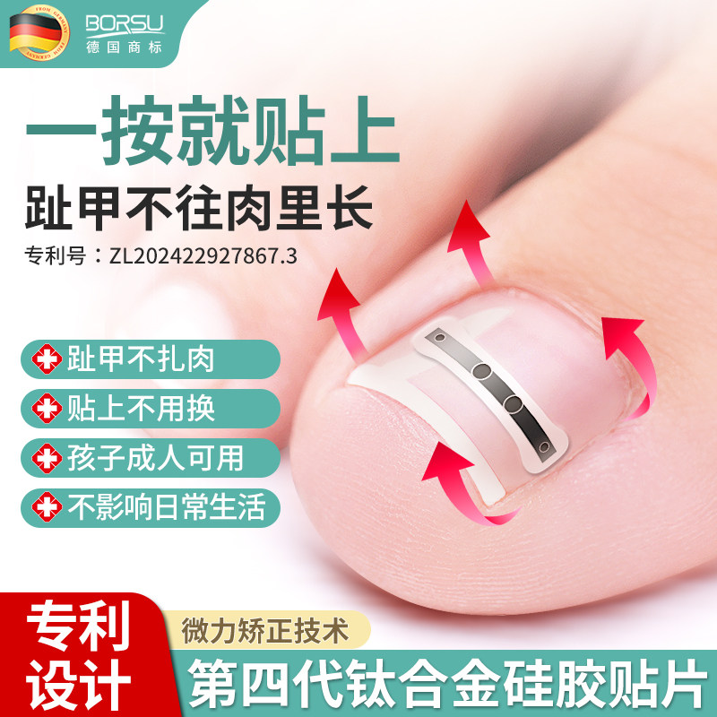 德国BORSU甲沟嵌甲矫正器炎正甲贴贴片脚趾指甲扎肉专用纠正神器