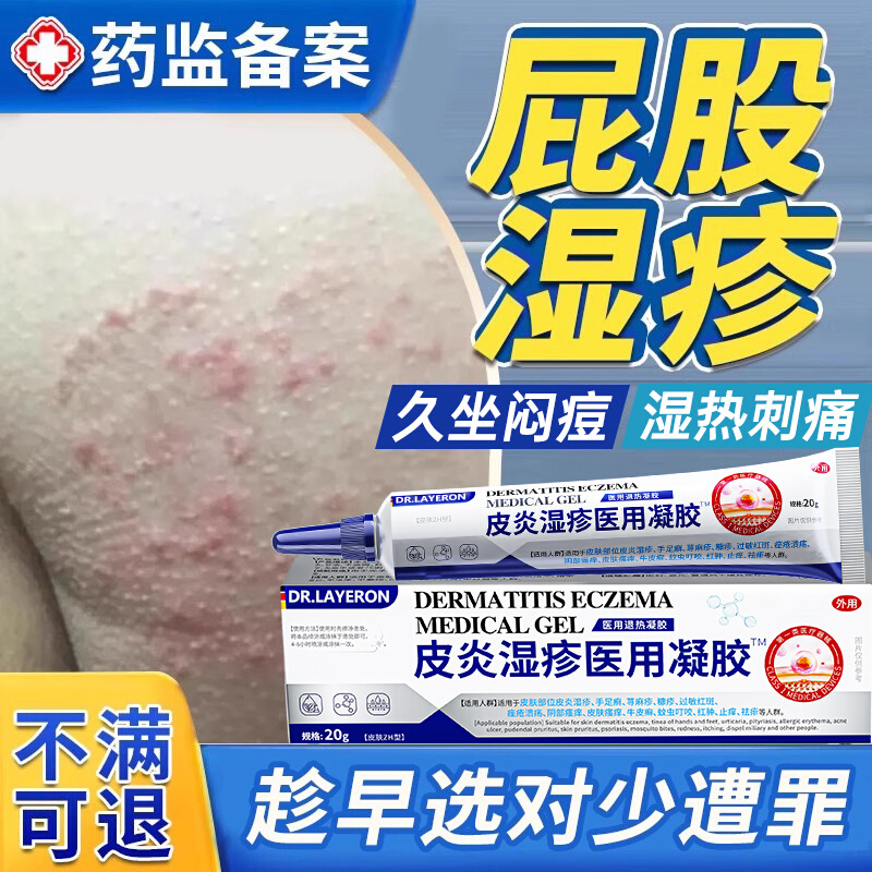 屁股湿疹上长痘痒起热疙瘩