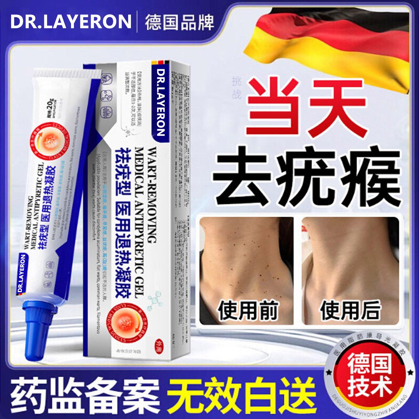 疣瘊肉粒一抹无忧去除扁平
