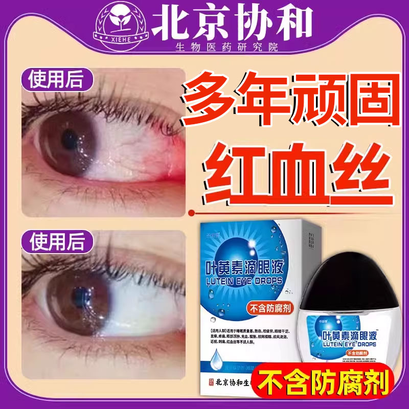 叶黄素眼药水滴液官方旗舰