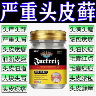 治头皮屑藓脂溢性皮炎皮牛银药去头部痒毛囊炎膏病真菌感染专用屑