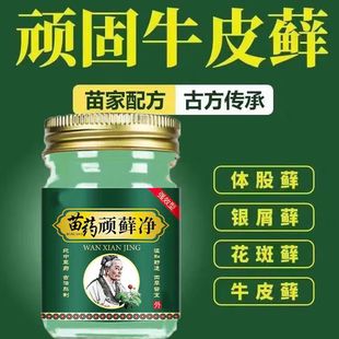 苗药顽癣净牛癣银屑头癣体癣手足癣皮肤痒癣膏全身适用草本配方