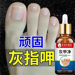 重度灰指甲發(fā)黃增厚強效修護除壞甲去灰甲溝炎專用抑菌液