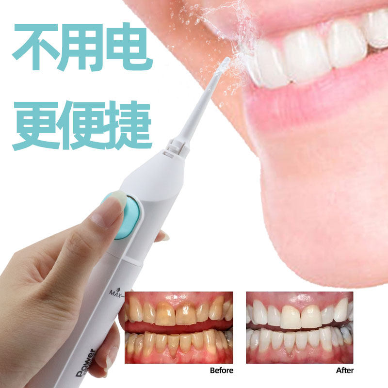 便携式手动冲牙器家用正畸清理洗牙神器水牙线口腔冲洗器蛀牙牙洞