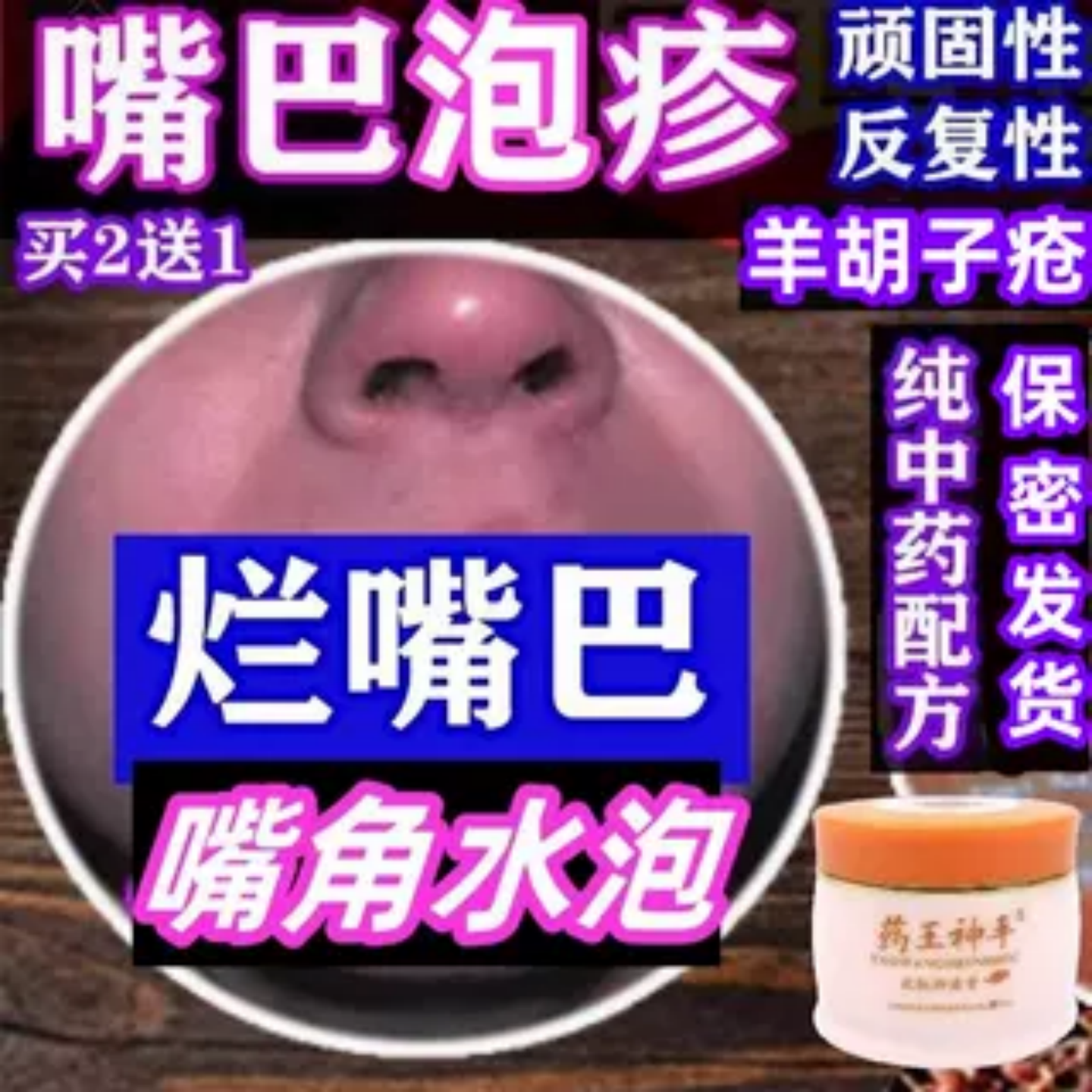 嘴巴水泡唇炎上火糜烂起皮乳膏