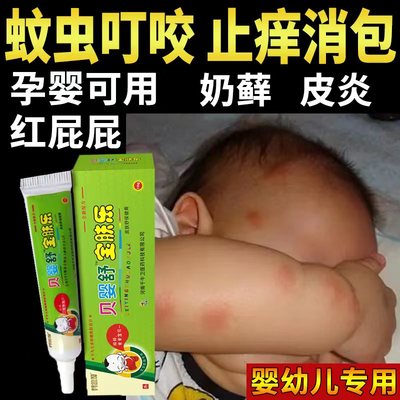 婴宝湿疹霜抑菌膏汗疹热疹药膏痱子干性红疹宝宝口水奶藓止痒抑菌