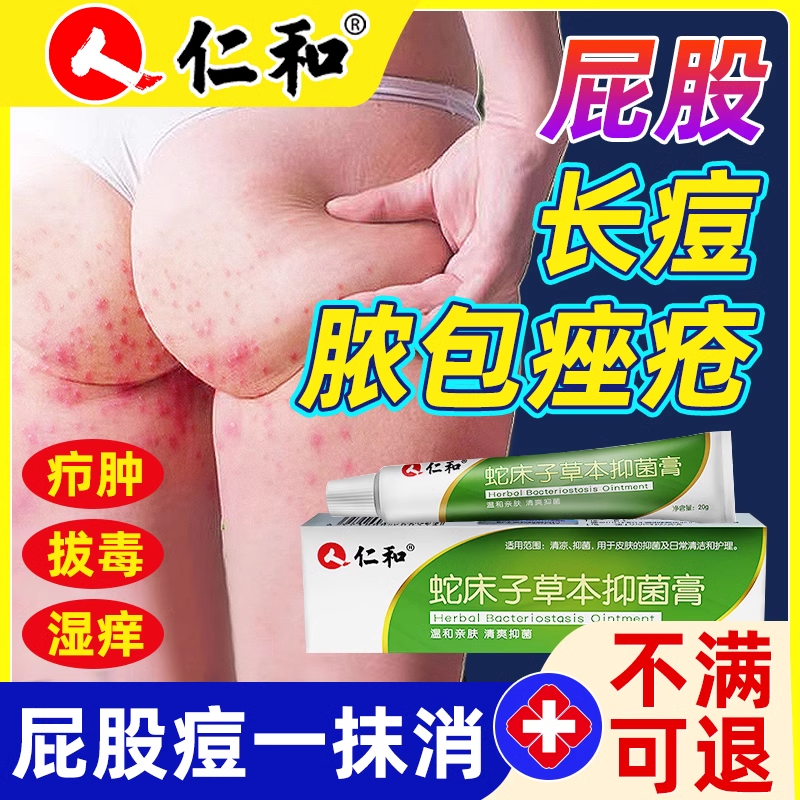 屁股上长痘痘痒起热疙瘩久坐板疮坐疮非止痒膏湿火疖子毛囊疹0kd