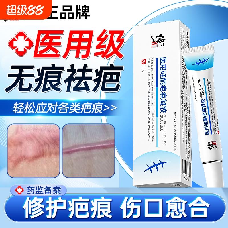 修正祛疤膏去疤痕贴修复除脸部手术疤儿童烫伤剖腹产专用医用7mi