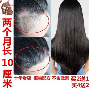 头发增长液快速短发变长发剂加快发际线浓密增发营养护发精油