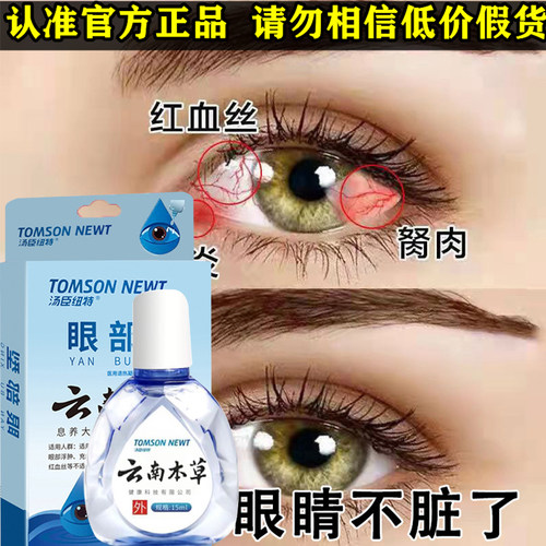 【自营】日本参天眼药水结膜炎滴眼液原装进口眼花眼药水滋润角膜