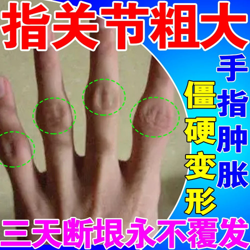 伤湿解痛膏伤湿膏红色时期膏药袋合售厘米带语录