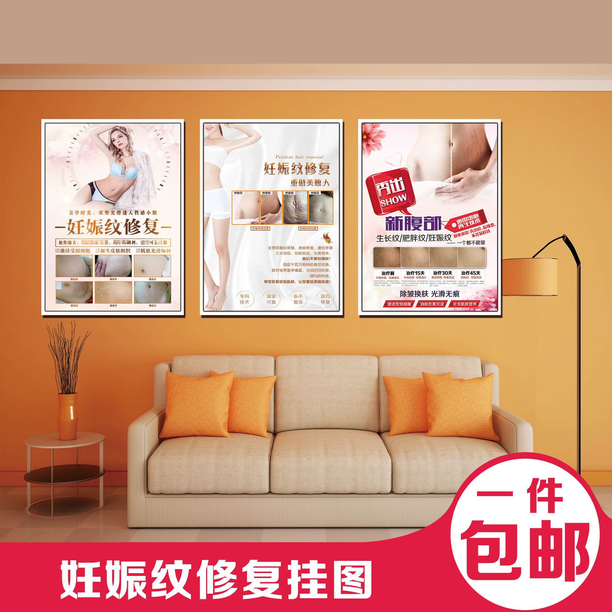 产后妊娠纹壬辰纹修复海报广告宣传画祛除妊娠纹装饰挂图kt板展板