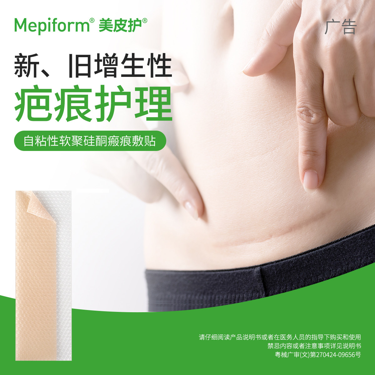 Mepiform/美皮护疤痕贴甲状腺