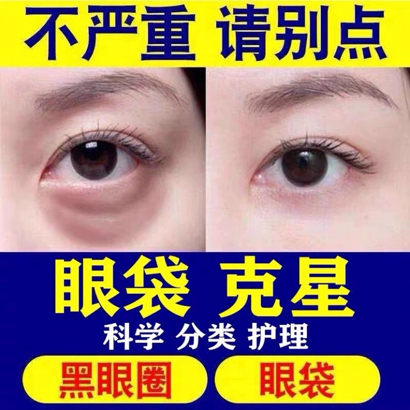 男士专用眼霜去黑眼圈眼袋淡化细纹皱纹抗皱抗衰老旗舰店官方正品