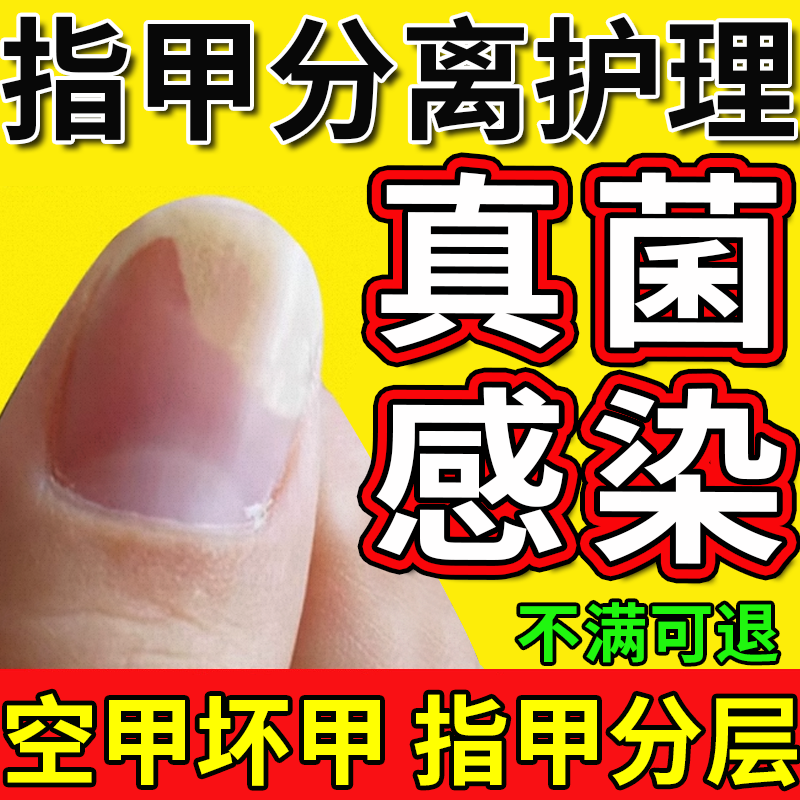 甲床分离引起空甲修空指甲液的药监备案真菌感染手专受损再用CS