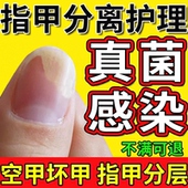 甲床分离引起空甲修空指甲液 药监备案真菌感染手专受损再用CS
