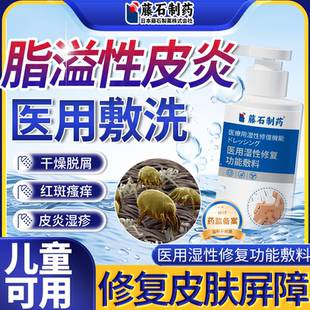 藤石制药头皮脂溢性皮炎头部面部真菌感染头癣喷剂洗发水男士CS