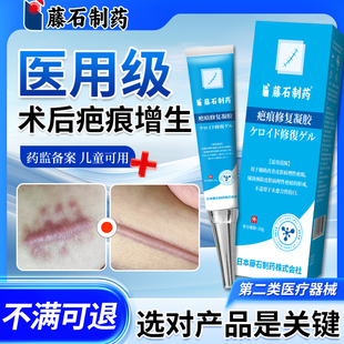藤石制药手术疤痕修复剖腹产缝针祛疤膏除疤痕增生凸起疙瘩贴去HY