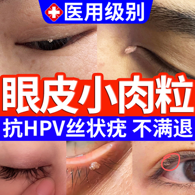 【医用级】眼皮肉粒抗HPV膏