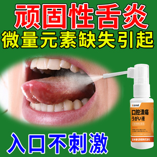 舌炎舌头喷雾上火溃疡舌裂纹有齿痕地图舌苔白厚溃疡特药监备案CS