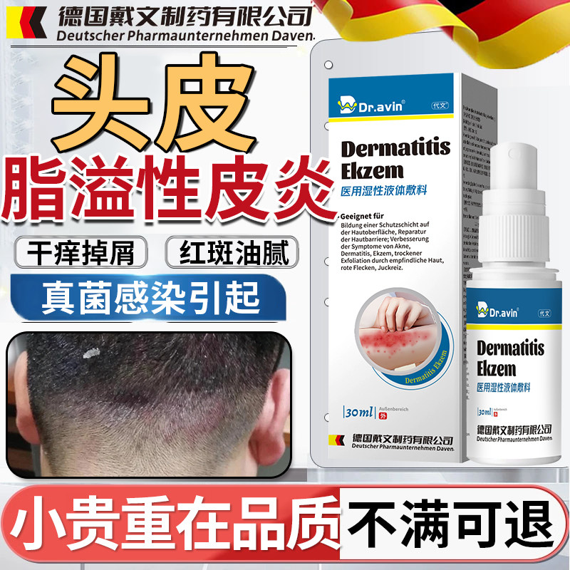 男士脂溢性皮炎头部喷剂头皮屑真菌感染头癣头痒毛囊炎搭洗发水SE