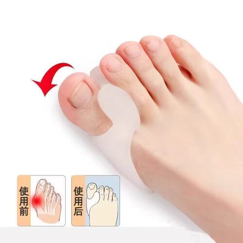 脚趾矫正器日本拇指外翻矫正器