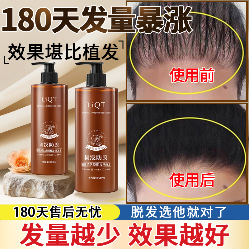 【发量越少效果越好】防脱洗发水