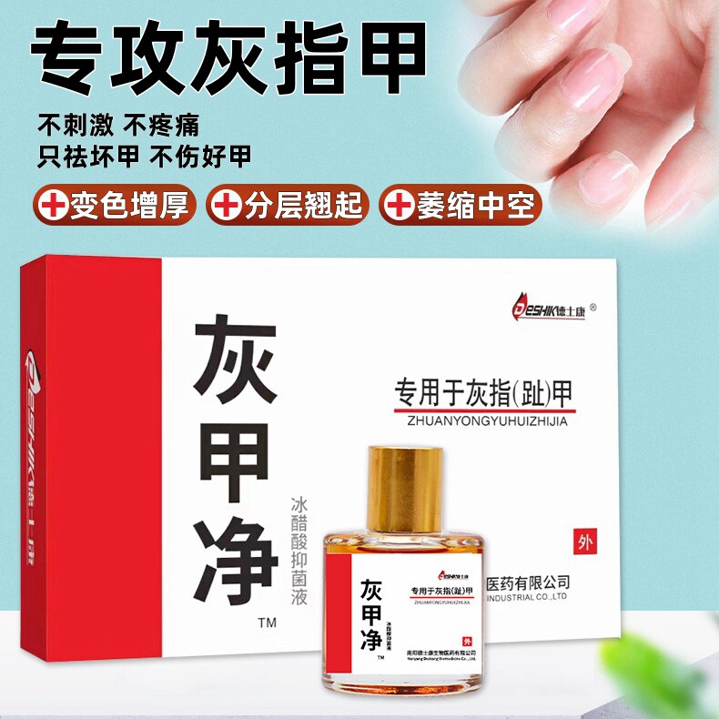 日本灰指甲抗真菌敷料冰醋酸指甲变厚甲沟炎变厚翘起变色萎缩变脆