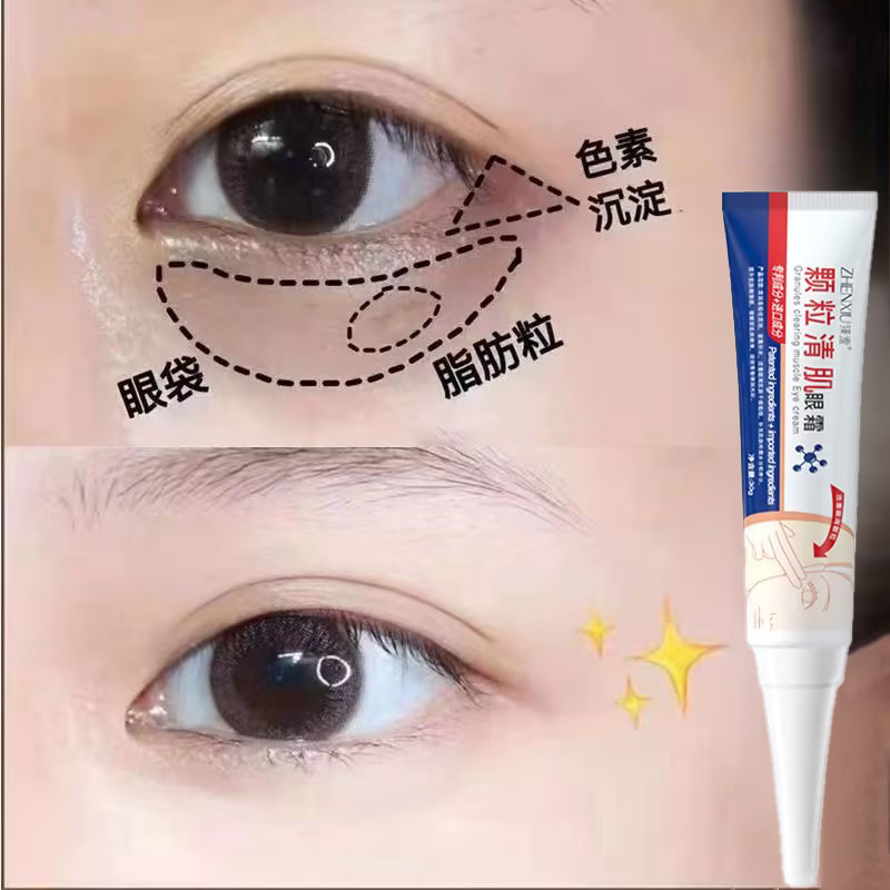 德国研发~脂肪粒去除神器眼部抗老祛皱专用眼角眼周眼霜旗舰店